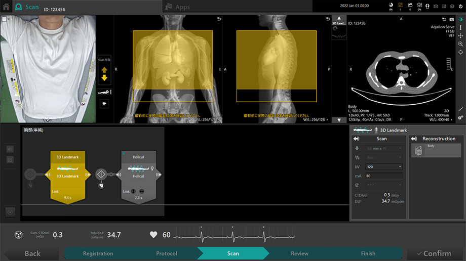 Image of the 3D data acquired by the low-dose scanning