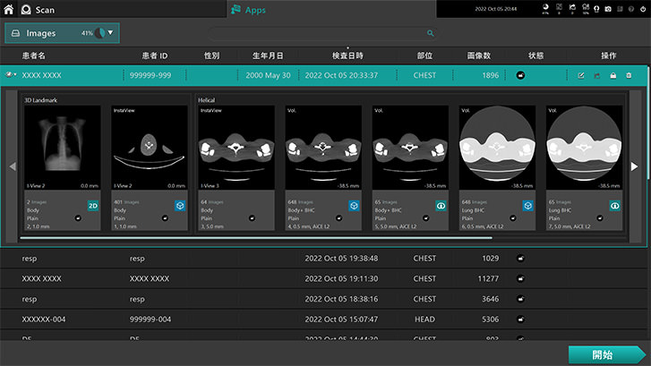 Image of a simplified and easy to use CT interface