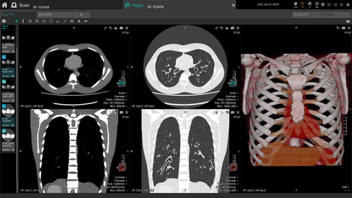 Image of a simplified and easy to use CT interface