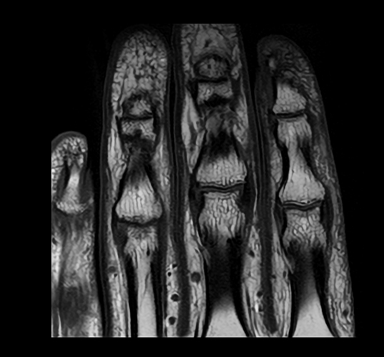 Clinical image of the fingers obtained with a Canon MRI system
