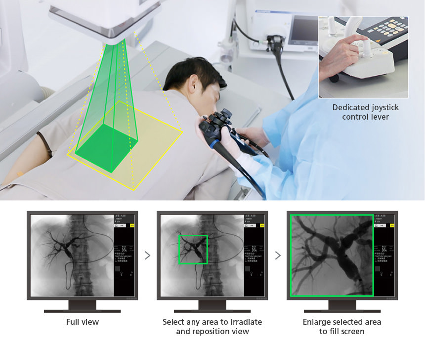 A compact, shallow-depth system enabling natural positioning around the X-ray table and enhanced procedural safety
