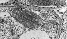 A carrot leaf scanned with the electron microscope equipped with CMOS sensors