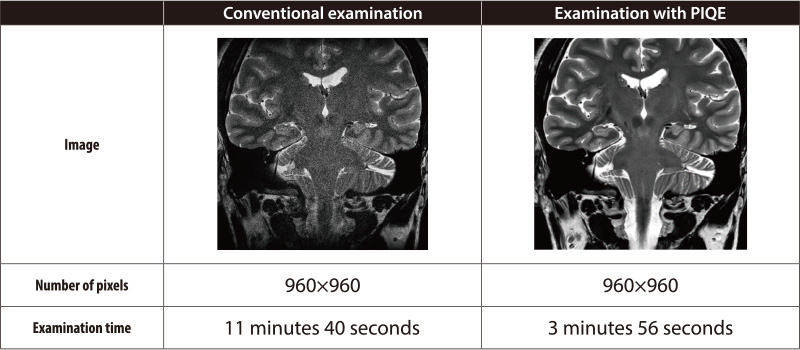 Noise reduction and high-resolution scanning technologies achieve improved image quality with shorter scan times